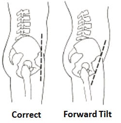 posture problems 2