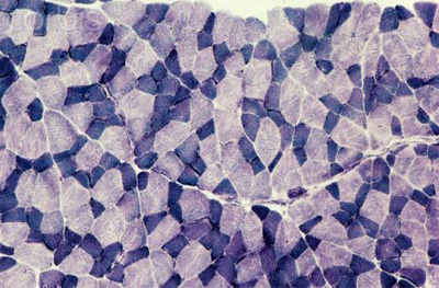 Muscle fiber types Muscle fiber types