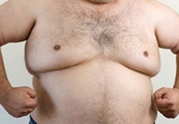 Why Do I Have Man Tits?: How to Lose Chest Fat