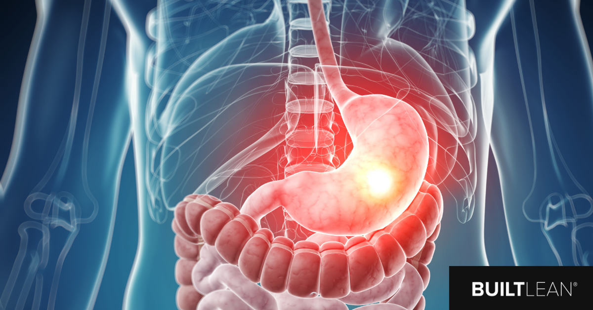 Is An HCL Supplement The Best Low Stomach Acid Solution