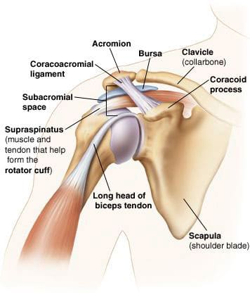 Steroid injection in back muscle